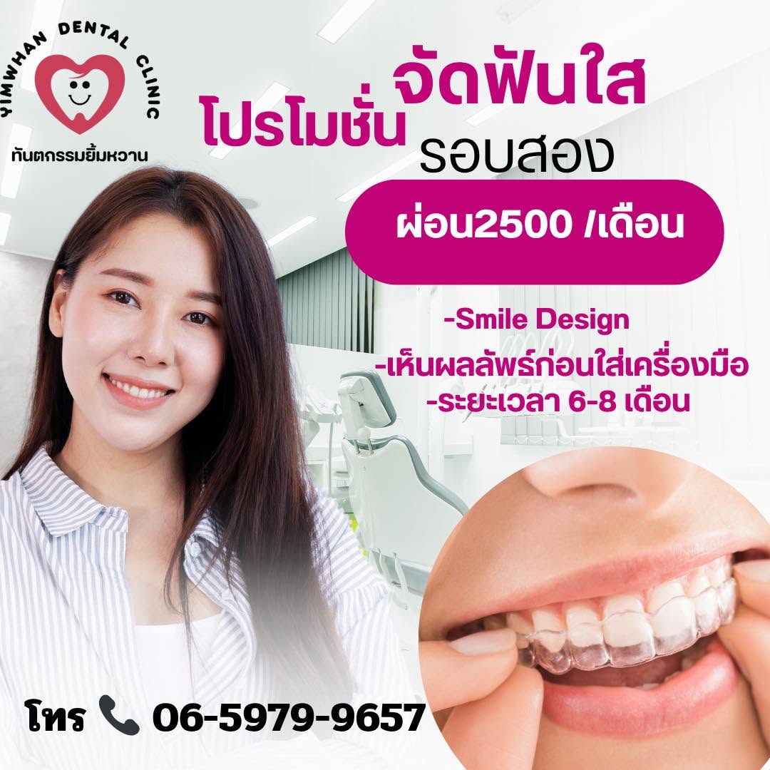 จัดฟันโปร 999.- ฟันยื่นฟันเหยิน